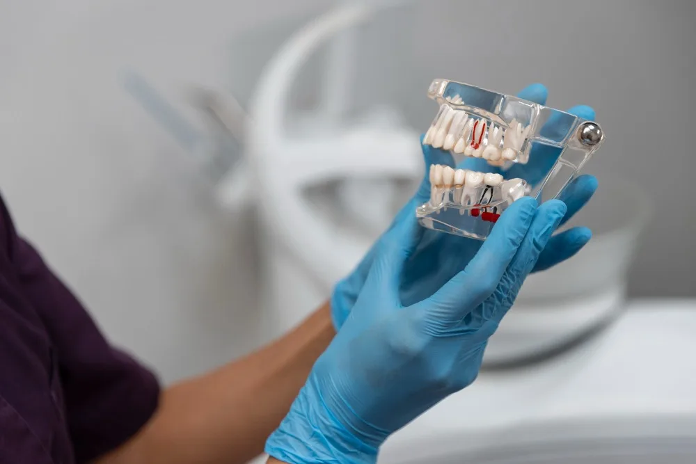 Home 4 Dental Implants