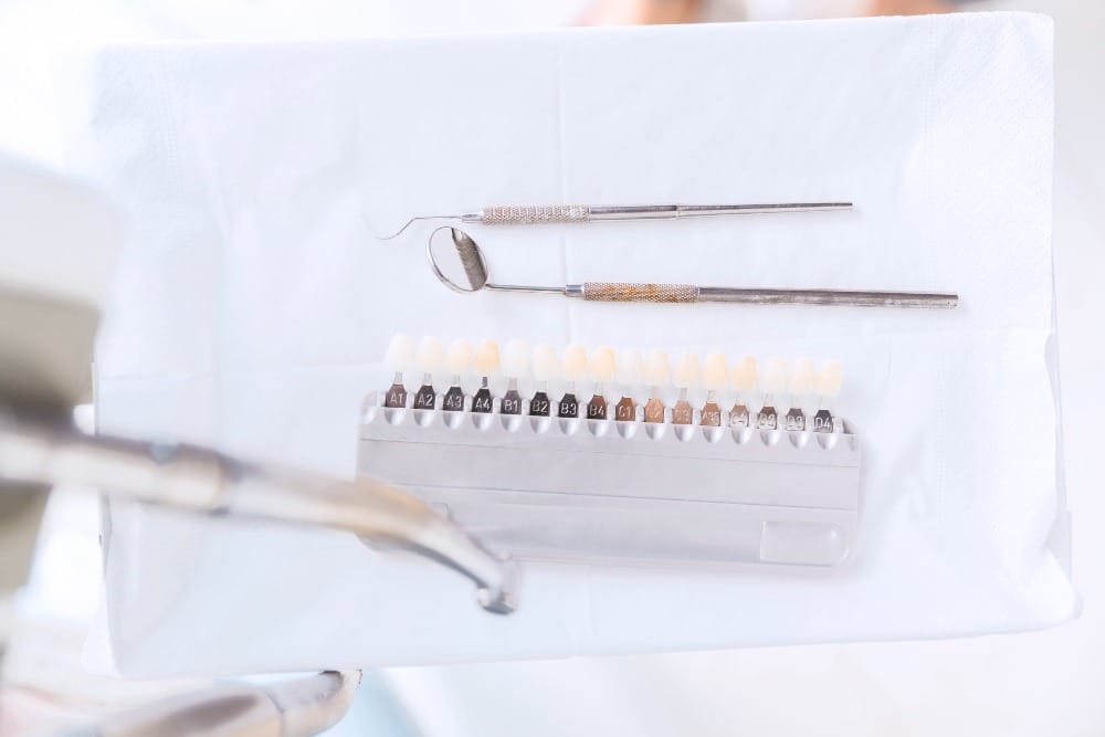 Dental Veneers 2 venn 2